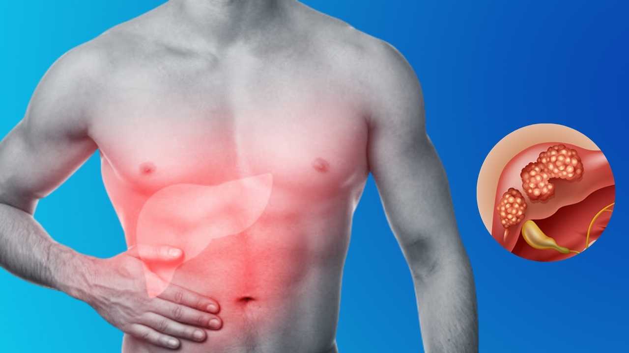 Zbulohet ilaçi i ri kundër kancerit që dyfishon mbijetesën Zbulohet ilaçi i ri kundër kancerit që dyfishon mbijetesën