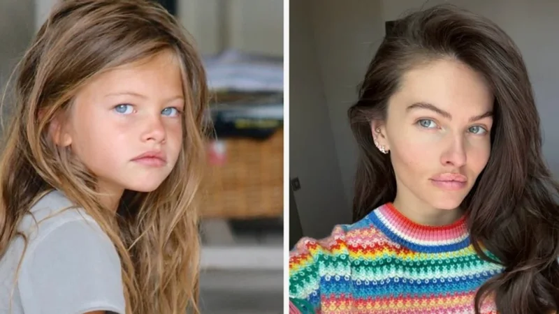 Dikur vajza më e bukur në botë, tani i’u përgjigjet akuzave rreth ndërhyrjeve kirurgjike Dikur vajza më e bukur në botë, tani i’u përgjigjet akuzave rreth ndërhyrjeve kirurgjike