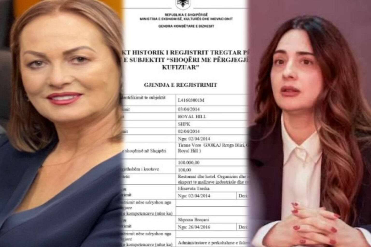 Rezultoi partnere në biznes me drejtoreshën e Sanatoriumit, Elisaveta Treska/ Reagon Shpresa Breçani: Te “Royal Hill” më emëroi Gjykata administratore të përkohshme. Vendimi jo nga pronarët! Rezultoi partnere në biznes me drejtoreshën e Sanatoriumit, Elisaveta Treska/ Reagon Shpresa Breçani: Te “Royal Hill” më emëroi Gjykata administratore të përkohshme. Vendimi jo nga pronarët!