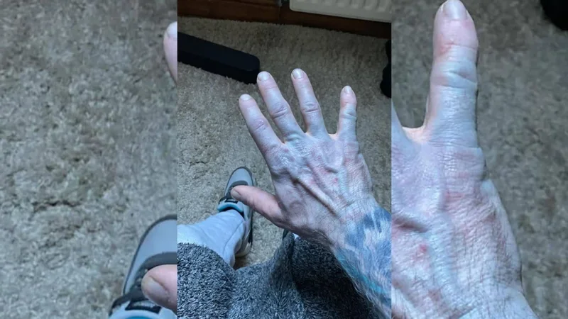 42-vjeçari zgjohet “si Avatar” dhe përfundon në spital! Çudia… kur zbulohet shkaku