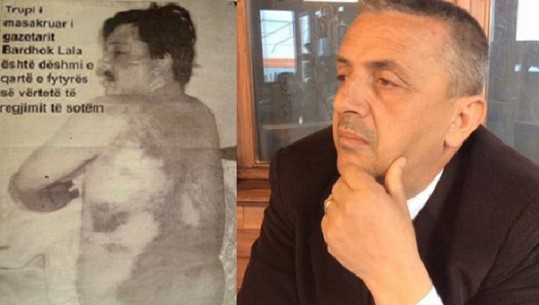 Ja pse dhuna e Sali Berishës ndaj gazetarëve nuk duhet harruar kurrë!