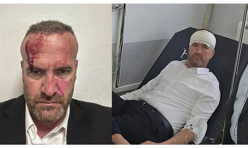 Sulmi ndaj zëvendësministrit Mehani, intervistohen dëshmitarë dhe të dyshuar për incidentin në Skenderaj