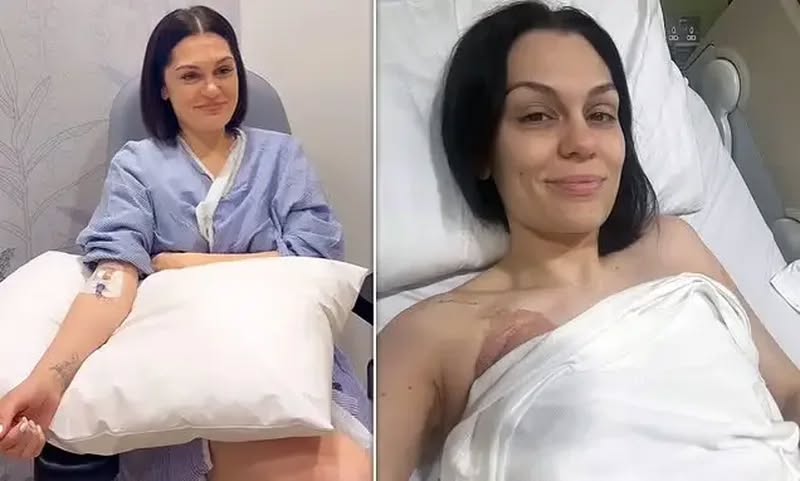 Jessie J zbulon se ka mposhtur kancerin: “Qava me orë të tëra”