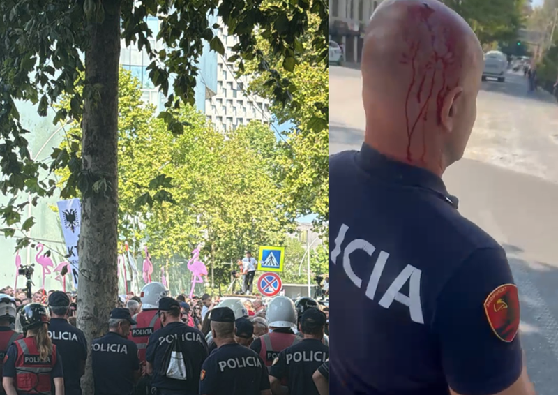 Polici i gjakosur nga gurët e protestuesve, Balla: Kjo nuk është më protestë paqësore, është terrorizëm Polici i gjakosur nga gurët e protestuesve, Balla: Kjo nuk është më protestë paqësore, është terrorizëm