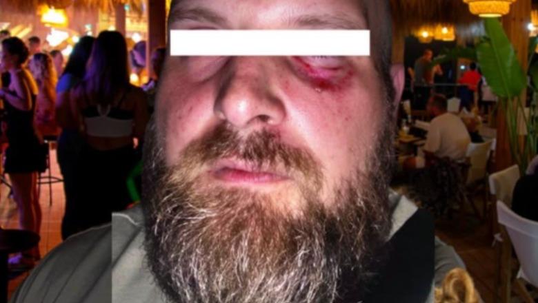 ‘E rrahën 7 kamarierë, policia nuk erdhi’, dhunohet në club-in e njohur në Golem turisti shqiptaro-gjerman ‘E rrahën 7 kamarierë, policia nuk erdhi’, dhunohet në club-in e njohur në Golem turisti shqiptaro-gjerman