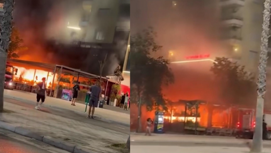 25-vjeçarja që i mbijetoi zjarrit në Vlorë niset për kurim në Turqi! Zv. kryeministrja Koçiu garanton mbështetjen e qeverisë: Ana nuk është vetëm, do të marrë trajtimin më të mirë! 25-vjeçarja që i mbijetoi zjarrit në Vlorë niset për kurim në Turqi! Zv. kryeministrja Koçiu garanton mbështetjen e qeverisë: Ana nuk është vetëm, do të marrë trajtimin më të mirë!