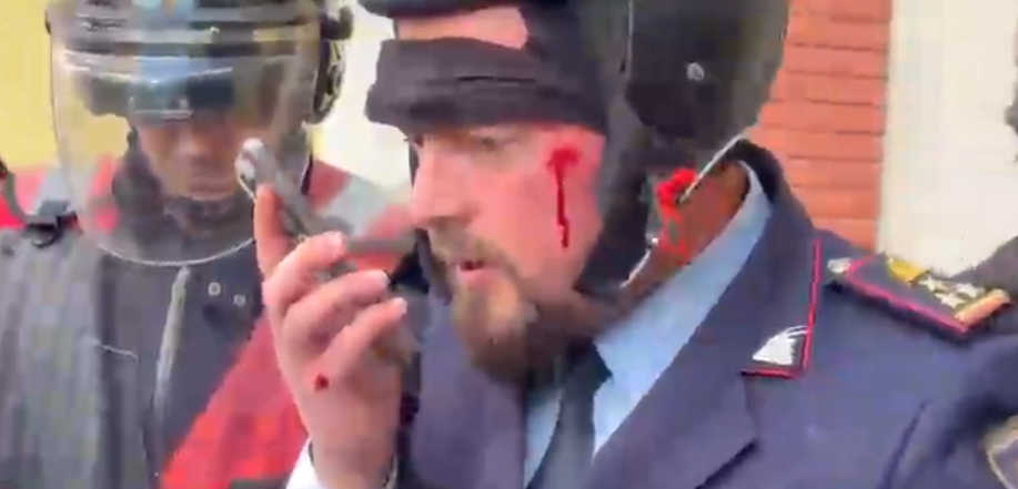 VIDEO/ E rëndë! Burri dhunohet nga protestuesit, pas rrahjes ia dorëzojnë policisë të gjakosur! I plagosur edhe nje polic VIDEO/ E rëndë! Burri dhunohet nga protestuesit, pas rrahjes ia dorëzojnë policisë të gjakosur! I plagosur edhe nje polic